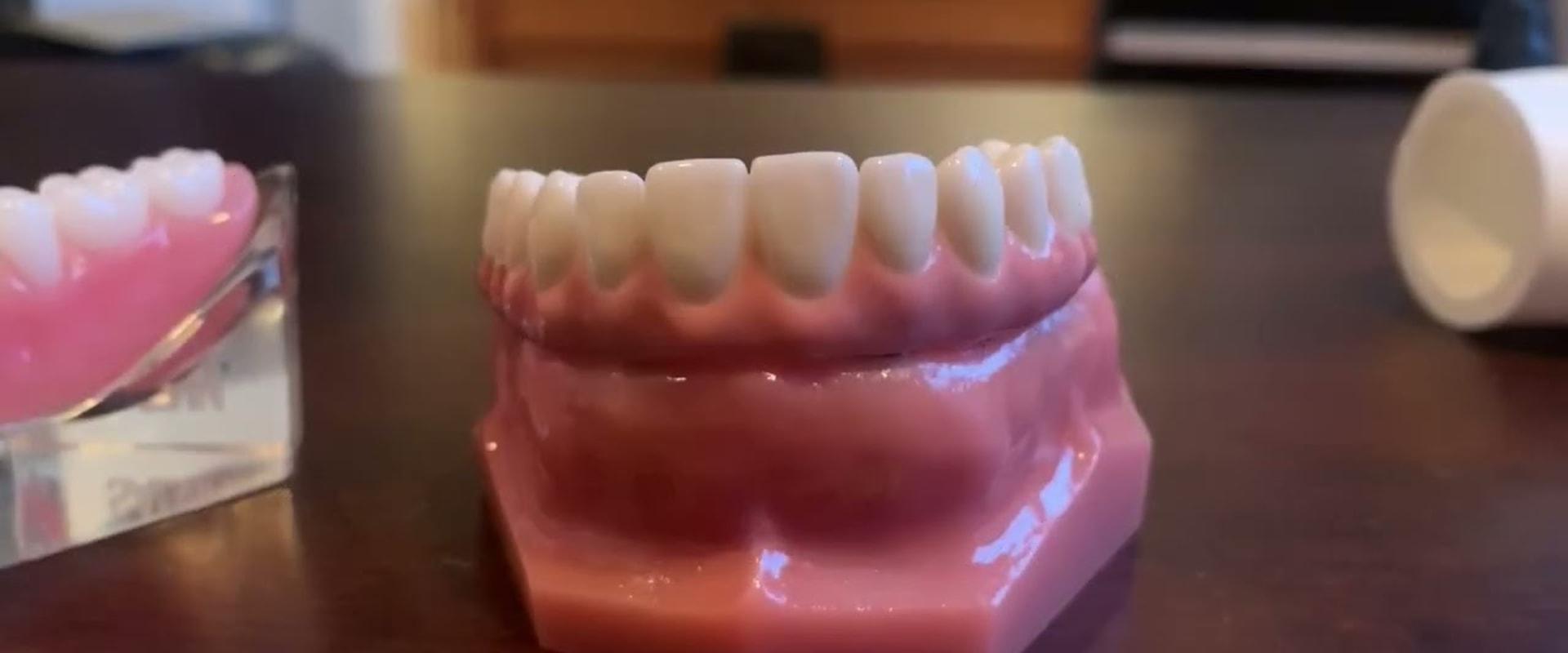 Why All-On-Four Dentures Are Changing The Game For Dental Restoration In Dripping Springs