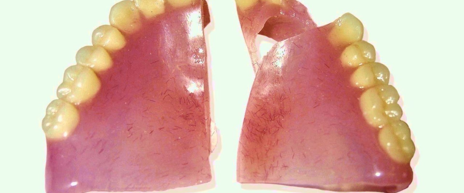 Can Broken Dentures Be Glued Back Together?