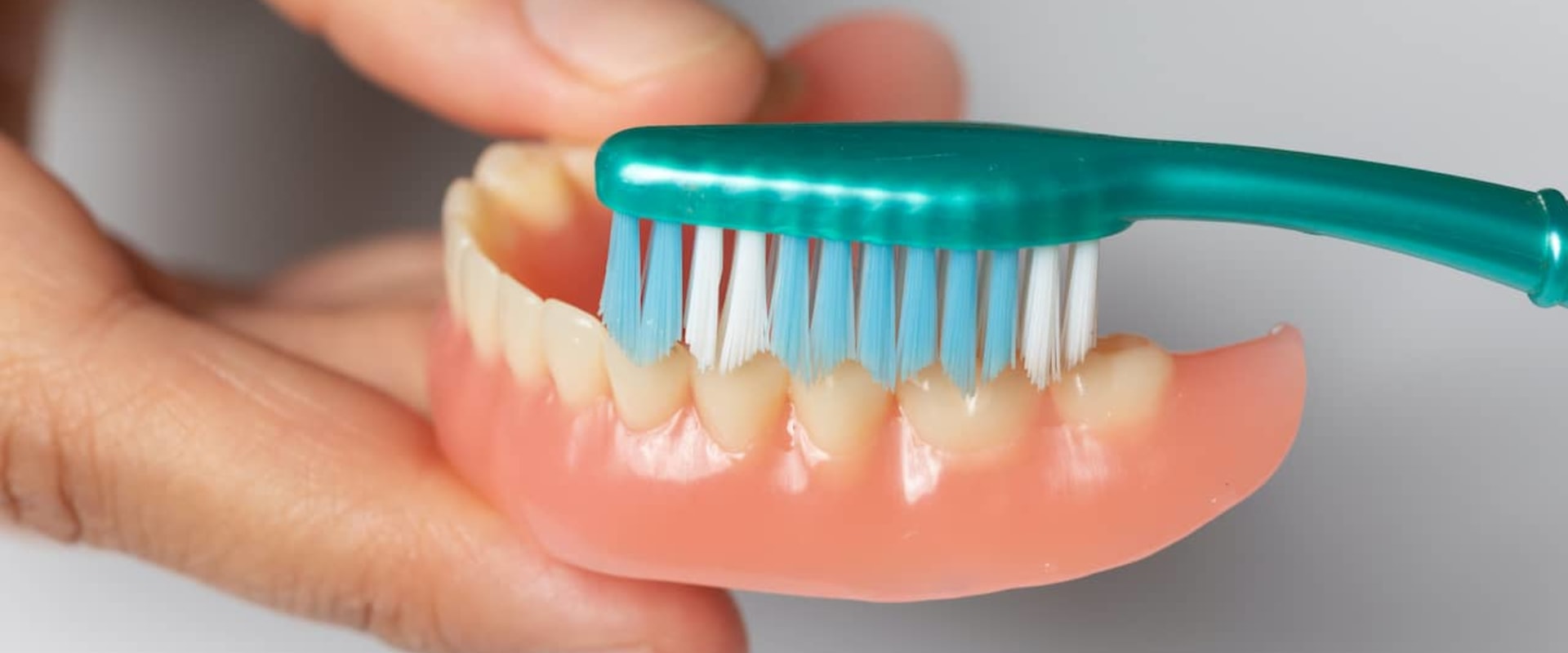 How to Whiten Denture Implants