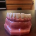 Why All-On-Four Dentures Are Changing The Game For Dental Restoration In Dripping Springs