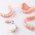 What Type of Dentures are the Most Comfortable and Cost-Effective?