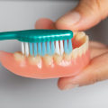 How to Whiten Denture Implants