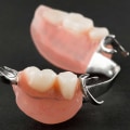 What Type of Dentures is Best for Missing Teeth?