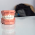 How to Get Natural-Looking Dentures