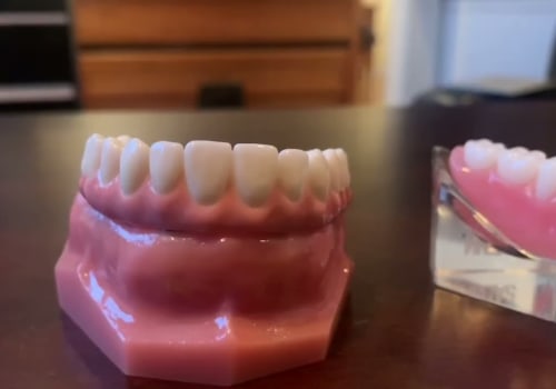 Why All-On-Four Dentures Are Changing The Game For Dental Restoration In Dripping Springs