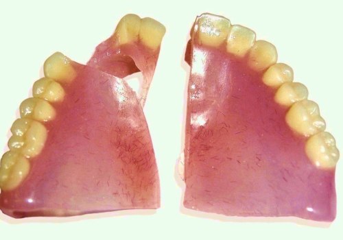 Can Broken Dentures Be Glued Back Together?