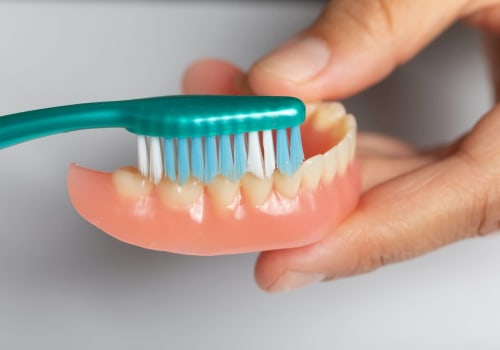 How to Whiten Denture Implants