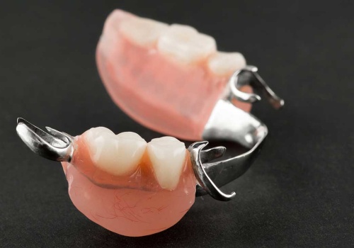 What Type of Dentures is Best for Missing Teeth?