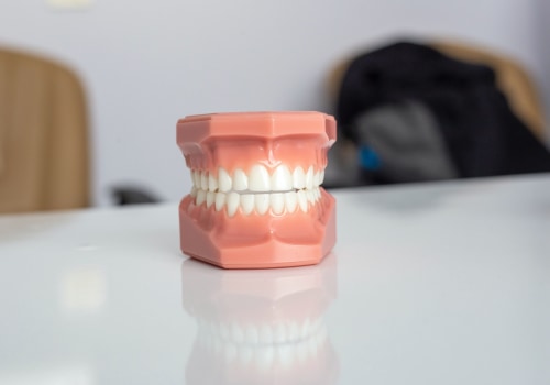 How to Get Natural-Looking Dentures
